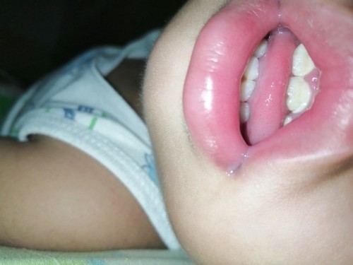 Baby teeth