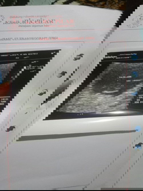 Bun aku mau nanya usia kandunganku sudah jalan 9 minggu kata bidan aku, tapi pas USG baru 7 minggu d