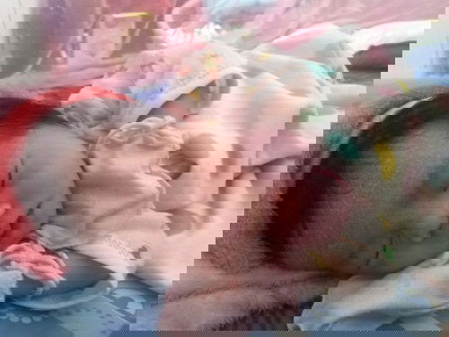 Bé 9ngay tuổi này là bé nổi gì v mng có cách nào trị k