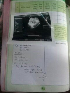 Perk Perbedaan bidan ama usg sangat jauh menurut bidan 10 minggu menurut usg 6 minggu