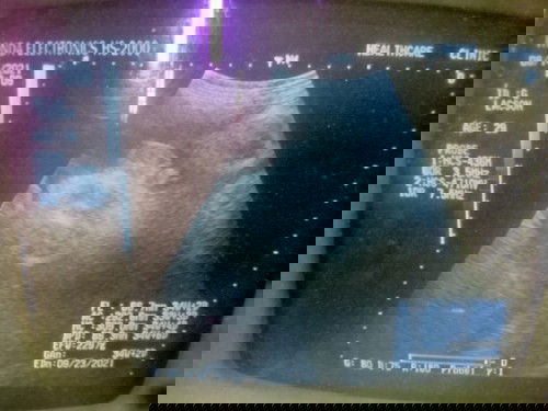 Magkaibang baby gender