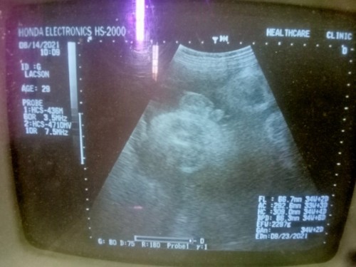 Magkaibang baby gender