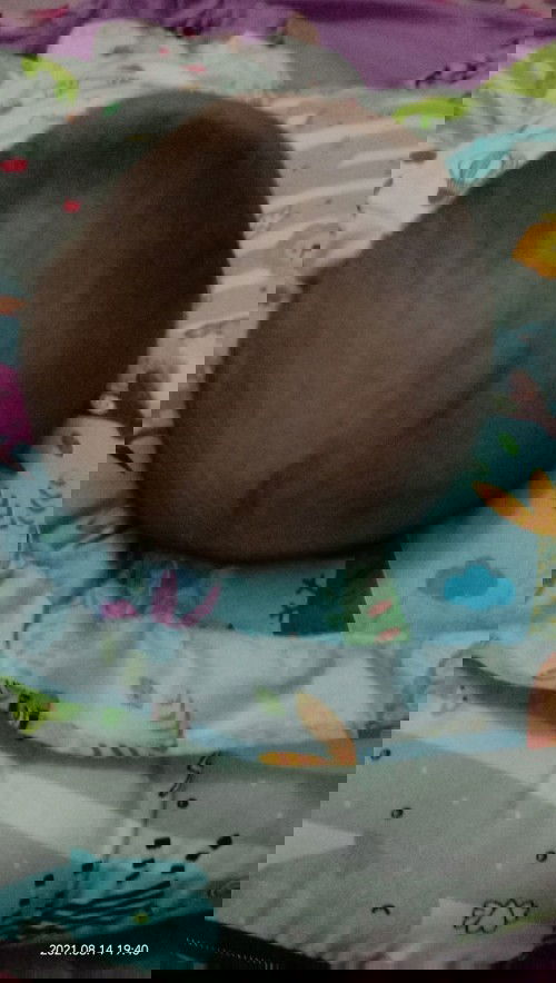 Kepala peyang usia 3 bln