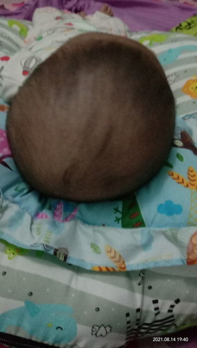 Kepala peyang usia 3 bln