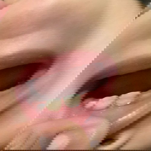 Baby teeth! help!🥺🥺🥺