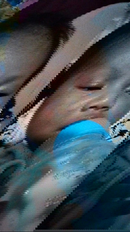 bintik putih seperti jerawat di wajah bayi