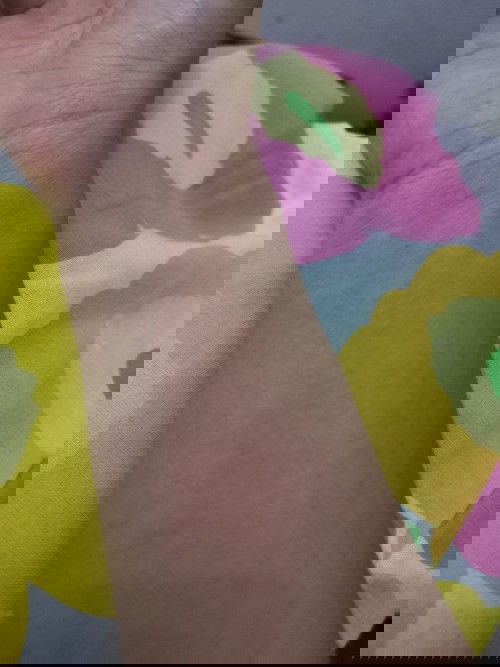 Gatal-gatal UK.23 weeks