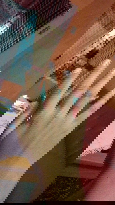 CTS (Carpal Turner Syndrome)