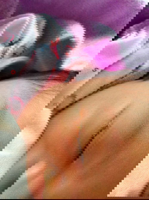 ลูกมีขี้ตาข้างเดียวมาสองวันเเล้ว