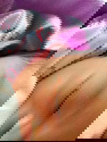 ลูกมีขี้ตาข้างเดียวมาสองวันเเล้ว