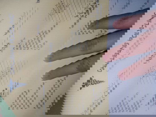 30 wks mga momsh d pa nbbsa ng ob q normal  po kaya lab results q???