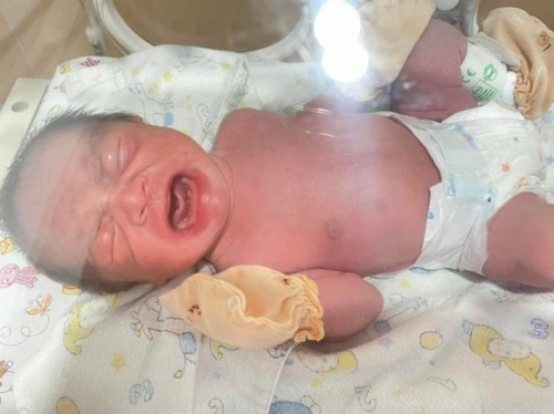 ต่อจากประสบการ์ณอาการเหมือนจะคลอด(แต่ในที่สุดก็คลอด)เมื่อวันจันทร์ที่26กรกฎาคมที่ผ่านมา🧡🤱🏼