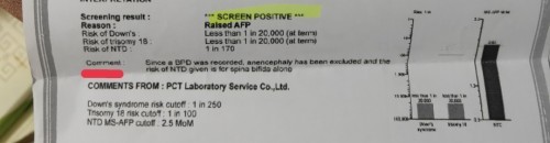 NTD 1:170 แม่อายุ 30 ปี ตอนนี้อายุครรภ์ 21 สัปดาห์