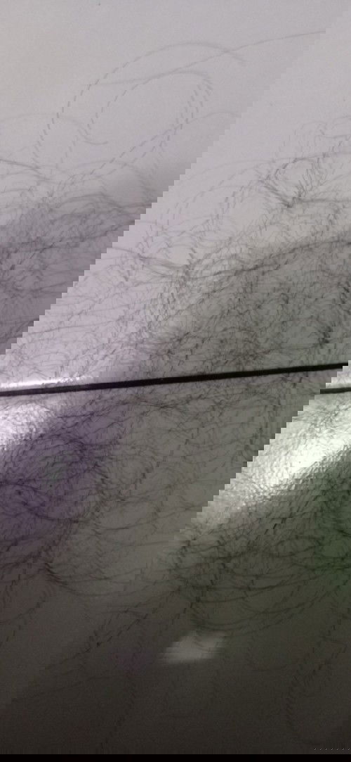 Rambut rontok pasca lahiran