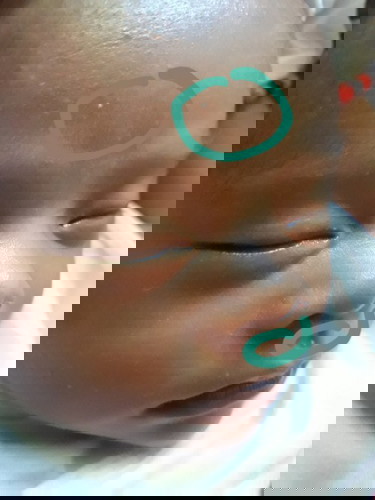 mnga mommies ano po kya i2ng puting prng tigyawt? since isinilang si baby at 17days npo now..