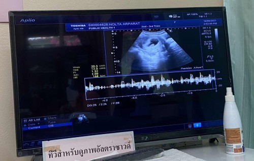 8 weeks ❤️ รู้สึกตื่นเต้นมาก ท้องแรกค่ะ