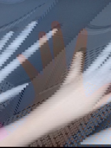 อยุ่ไตรมาส3 มือเท้าบวมแบบนี้ ไกล้คลอดหรือครรภ์เป็นพิษ