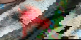 ภาวะแท้งคุกคาม