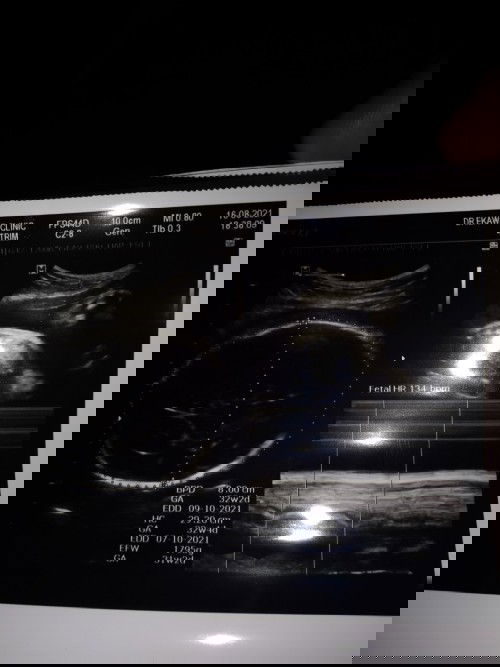 หนีโควิดจากกทม.มาฝากท้องต่อที่บ้านแล้วค่ะทีมตุลาตอนนี้33wแล้วค่ะใกล้เข้ามาเต็มทีแล้วอยากเจอแล้ว😍😍