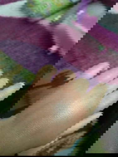 Salam asian parent..nak tanya kenapa tangan anak bengkak macam ni..kena gigit apa ye..anak tk nangis