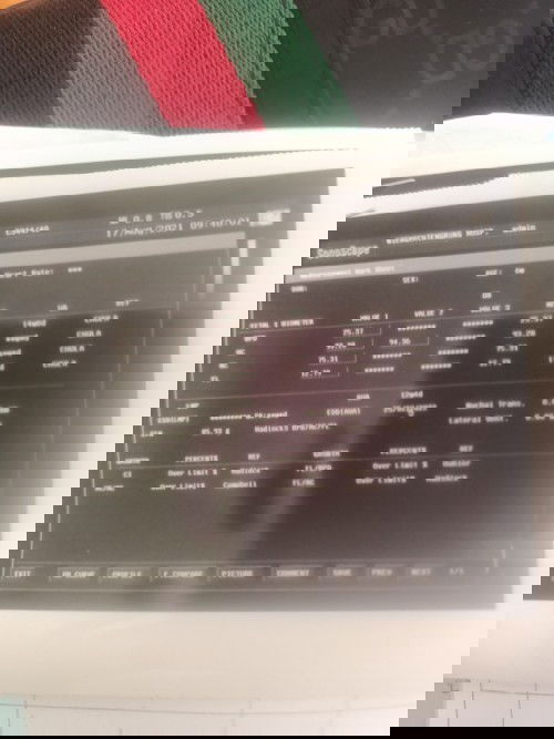 ปกติไหม หมอไม่บอกอะไรเลยค่ะ