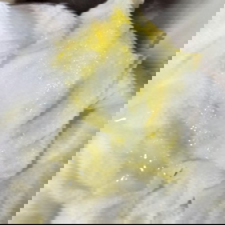 Hi po Worried nanay here ask lng po pls pasintabi po