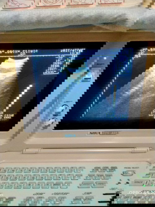 DUE DATE , FIRST TIME MOM