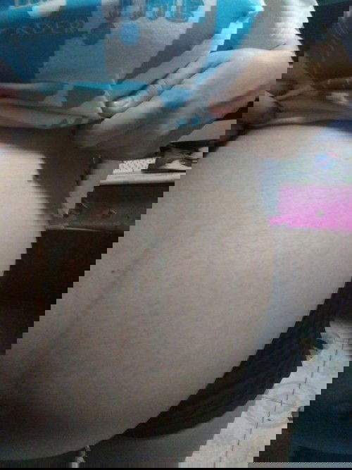 hello mga momsh, sino po dito ung buntis na nagkarashes ang tiyan? ano po epekto kay baby? Thanks po