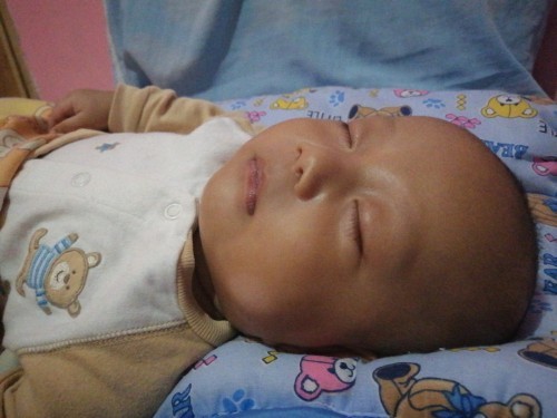 baby skin discolouration