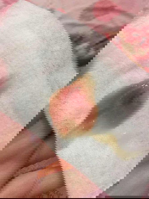 กระตุ้นคลอดแล้วมีมูกเลือด