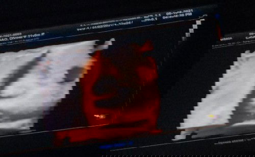 We are having a ....