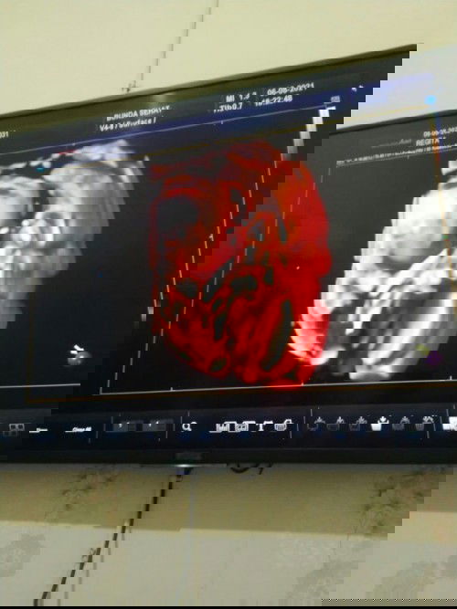 Masih penasaran tentang jk nya si dd..