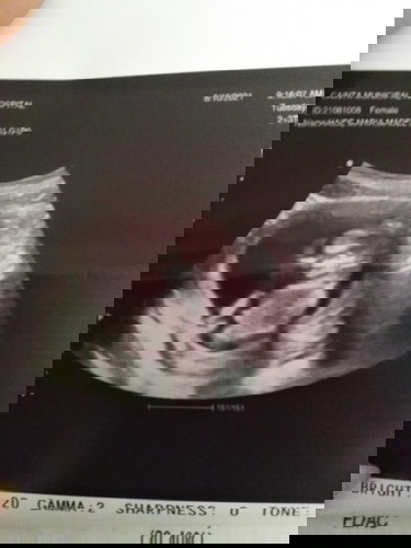 First time mom❤️