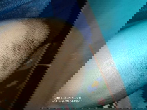 umur 3bln benjolan belum hilang