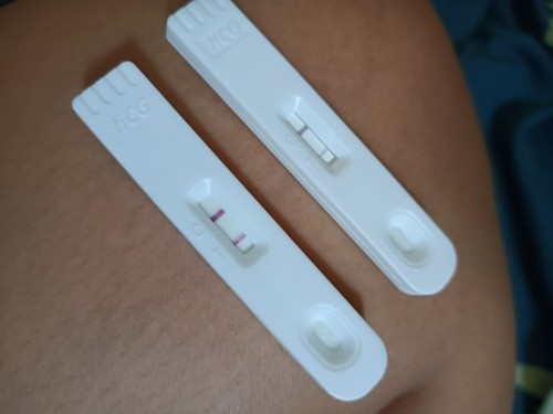 Hi diagnosed ako ng PCOS since 2019