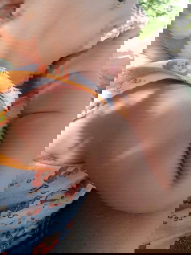 มีผื่นหลังฉีดวัคซีน