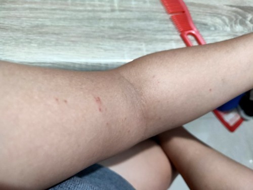 Red bumps
