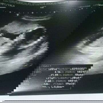 น้อง4เดือนกว่าแล้วนะค่ะแม่ๆกี่เดือนแล้วค่ะ
น้องตัวใหญ่มาก👶❤️