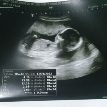 น้อง4เดือนกว่าแล้วนะค่ะแม่ๆกี่เดือนแล้วค่ะ
น้องตัวใหญ่มาก👶❤️