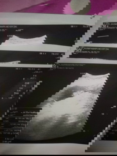 ตอนนี้19w แม่เลี้ยงเดี่ยว