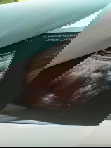 Penebalan dinding rahim usia 4week