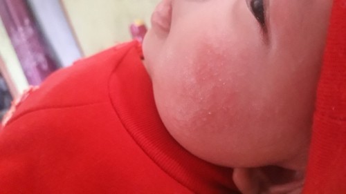 Pipinya ada merahnya dan kering