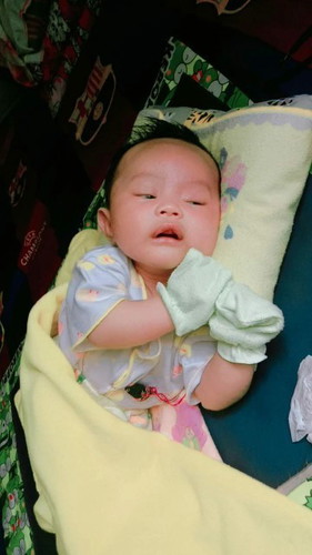 Nafas seperti ada dahak