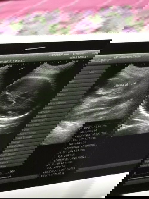 7 เดือนแล้วคะ อยากทราบว่ามีแม่ๆคนไหนพอจะดูออกบ้างค่ะ