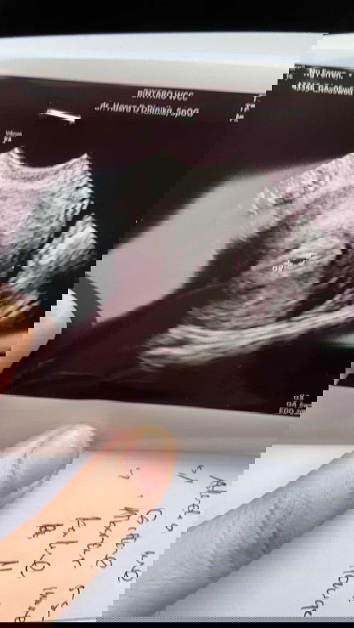 Pendarahan di awal kehamilan