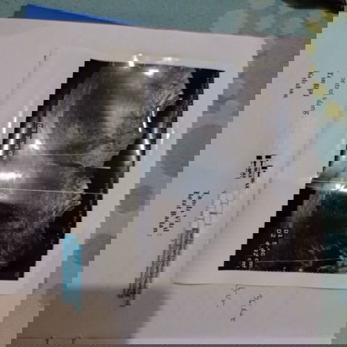 Hamil tapi kantung belum terlihat