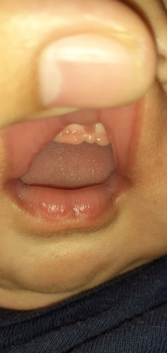 3 months and 16 days