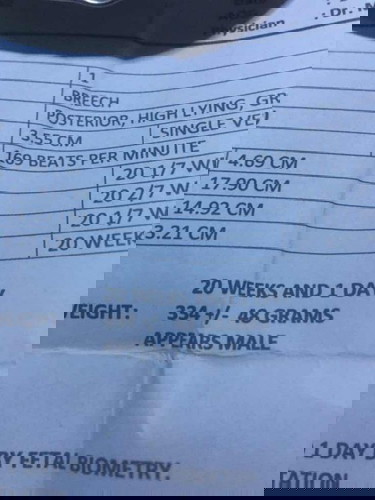 HELLO PO NORMAL PO BA ANG 48 GRAMS FETAL WEIGHT NG 20 WEEKS PREGNANT?