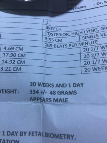 HELLO PO NORMAL PO BA ANG 48 GRAMS FETAL WEIGHT NG 20 WEEKS PREGNANT?