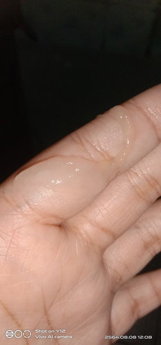 คนท้องมีมูกใสไหม